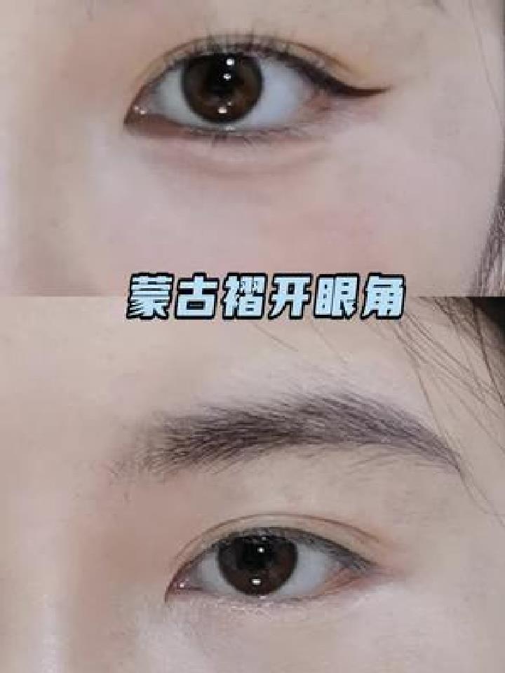 蒙古褶是啥